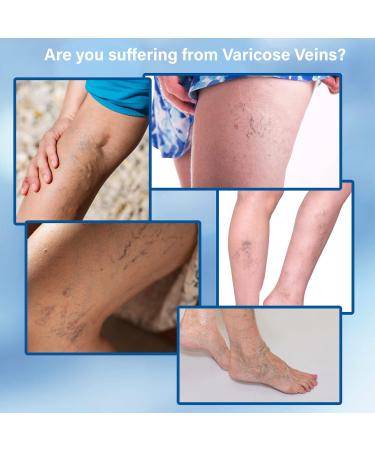 WosAna Varicose Vein Cream - Natural Spider Veins Treatment for Improved Leg Appearance and Circulation - Buy Online on GoSupps.com