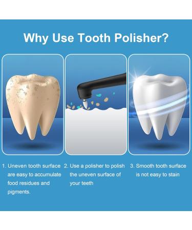 SIQUER Tooth Polisher - Electric Plaque Remover & Teeth Whitening Kit with 5 Speed Modes LED Light & 5 Brush Heads - Effective Dental Tool for Home Use - Buy Online on GoSupps.com
