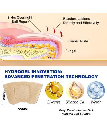 Toenail Fungus Treatment Extra Strength | 32 Nighttime Fungal Nail Patches | Fast Results in 8 Hours - Buy Online on GoSupps.com