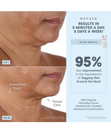 NuFACE TRINITY+ and Effective Lip & Eye Attachment - Buy Online on GoSupps.com