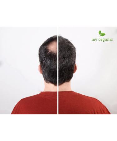 Buy My Organic Hair Defection Spout - 100% Natural & Vegan Hair Color - 26g - Immediate Effect for Medium Blonde Shades - Buy Online on GoSupps.com