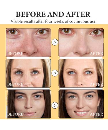 2pcs Frankincense Resin Oil Frankincense Infused Face Oil Infused With Organic Black Seed Castor And Jojoba Oil Facial Moisturizing Anti-Aging Serum - Buy Online on GoSupps.com