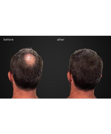 MAXX PRO Series Volumizing Hair Fibers with Real Keratin | Hypoallergenic & Dermatologist Tested | 60 Days Supply for Hair Loss (Gray) - Buy Online on GoSupps.com