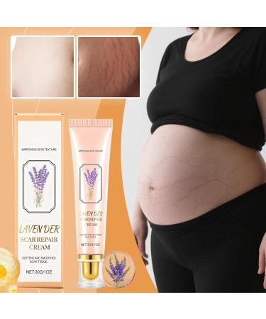  Generisch Scar cream for women | Skin texture improvement compact products | Moisturizing scar removal lotion for men women teens athletes sons daughters - Buy Online on GoSupps.com