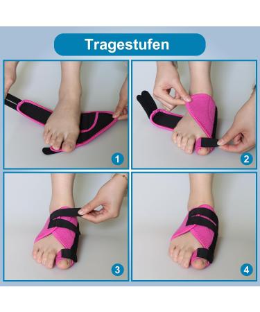 Hallux Valgus Correction Rail for Big Toe Pain Relief - Adjustable Bandage for Men & Women (Rose Red Right) - Buy Online on GoSupps.com