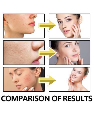 Anti-Aging Bee Venom Facial Gel Moisturizer | Anti-Wrinkle Cream with Collagen & Hyaluronic Acid | Firming Face Cream for Fine Lines - Buy Online on GoSupps.com