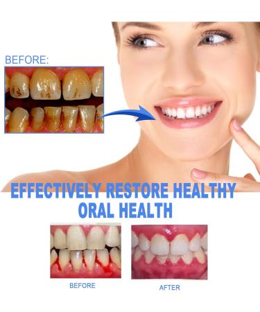 Gums Therapy Gel - Repair Swollen Gums Reduce Pain & Deep Clean Teeth Stains - 3 Piece Set - Buy Online on GoSupps.com