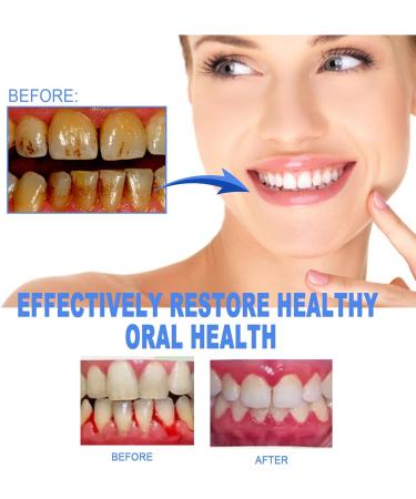 Buy Lovilds Gum Therapy Gel & Gum Shield 3PCs for Optimal Gum Health | International Shipping Available - Buy Online on GoSupps.com