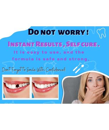 Temporary Tooth Replacement Kit Bundle Set - 30 Fake Teeth in 3 Shades - Includes Temp Tooth Beads, Lip Expander, and 200 Thermal Beads - DIY Tooth Replacement Solution - Buy Online on GoSupps.com