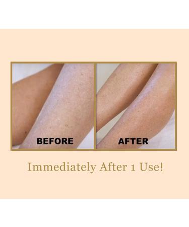 DIAMONDBUFF Microderm Exfoliation Tool - At Home Diamond Microdermabrasion for Youthful Glowing Skin Softens Crepey Skin & Fine Lines - International Shipping Available - Buy Online on GoSupps.com