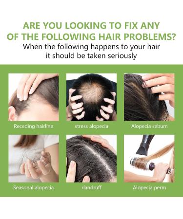 CLFJLXYX Rosemary Oil Hair Growth Oil - 100% Organic Rosemary Hair Oil Rosemary Essential Oils Effective Hair Thickening Hair Mask & Hair Loss Treatment Hair Treatment Oil Damaged Hair Care 2.11 Fl Oz - Buy Online on GoSupps.com