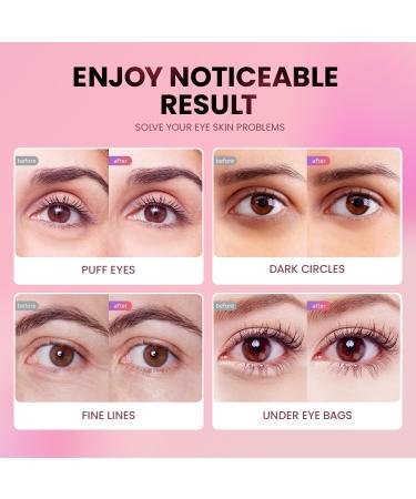 Under Eye Patches (24 Pairs) - Tri-Color Glitter Gel Pads for Dark Circles Puffiness & Wrinkles | Natural Collagen Eye Mask for Women & Teens - Buy Online on GoSupps.com