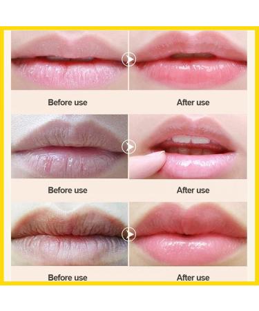 PLUMP IT Moisturizing Lip Mask by Doppeltree - 18 Patches for Dry, Chapped Lips - Lip Plumper & Conditioner - San Francisco Formula - Buy Online on GoSupps.com