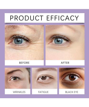 Eye Stick Anti Wrinkle Eye Cream for Puffy Eyes Dark Circles Eye Bags Crows Feet Wrinkles Eye Cream Korean Instant Firm Eyes Reduces Wrinkles Saggy Skin Puffy Eyes 15g/ 0.53OZ (2) - Buy Online on GoSupps.com