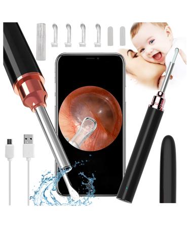 Ear Wax Removal  Ear Cleaner Camera 500 Million PX Full HD Ear Wax Removal Tool Camera USB Wireless Ear Cleaning Endoscope Earwax Removal Kit for iPhone  iPad  Android Smart Phones Adults Kids & Pets upgrade