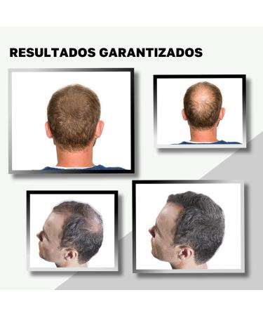 VIDALFORCE Premium Hair Densification I 100 Natural Ingredients I hair powder for full hair in seconds helps cover light hair protects against bald spots Light Brown Pack 2 x 30g - Buy Online on GoSupps.com