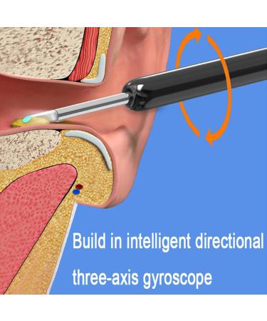 Smart Visual Ear Wax Removal Tool - LED Otoscope Endoscope Ear Cleaner for Visible Wax Elimination & Ear Health Care - White - Buy Online on GoSupps.com