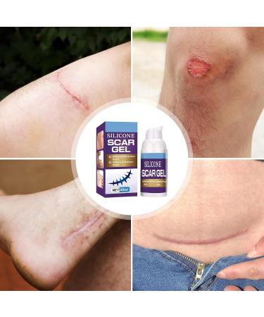 Effective Scar Cream for Old & New Scars | Smooth Skin Care - 30 ml | International Shipping Available - Buy Online on GoSupps.com