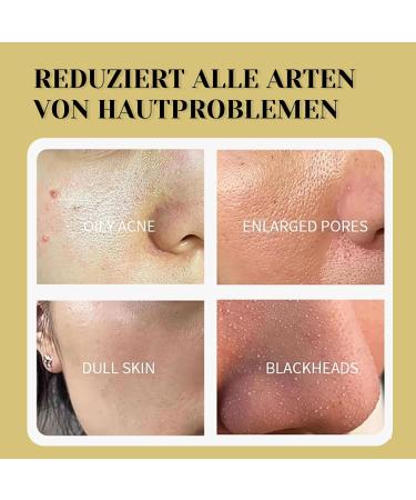 Dead Sea Mask Deep Cleansing Face Mask Skin Care Improve Blackheads Acne Dark Spots Even Skin Tone Face Mask Control Oil Refining Pores (Turmeric) - Buy Online on GoSupps.com
