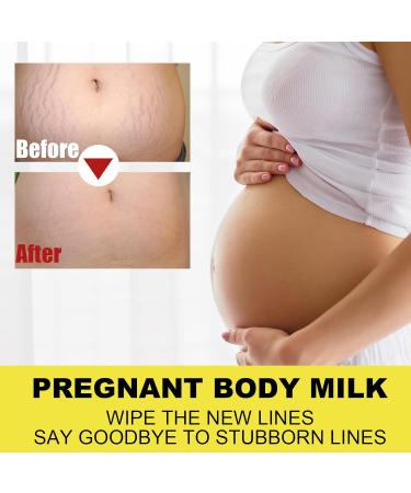 Stretch Mark Cream Prevention Stretch Mark Cream Skin Hydration Whitening Specialized Care for Stretch Marks Dry Skin and Irregular Skin Fragrance Free - Buy Online on GoSupps.com