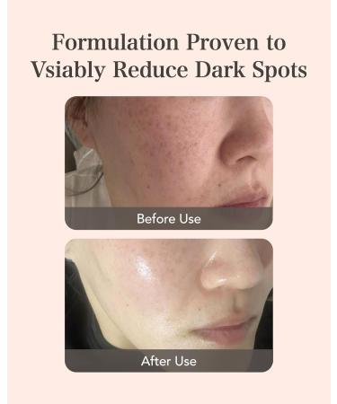 MASTINA Mastic Ampoule Serum - Even Skin Tone & Elasticity - 0.5fl oz Dropper - Buy Online on GoSupps.com