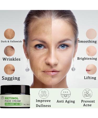 Retinol Face Cream Collagen Boost Face Moisturiser Firming Night Cream for Repair Anti Aging Face Cream for Women Deep Hydrating & Anti Wrinkle & Lift Sagging Skin Retinoid Cream-Smooth Fine LInes - Buy Online on GoSupps.com