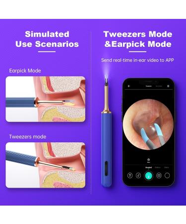 1000W Pixel Ear Cleaner with Camera Intelligent Visual Ear Picking Stick Tweezers/Ear Removal Dual-mode Ear Wax Removal with 12 Ear Spoons Omni-Direction Tweezer Real-Time Remote Video - Buy Online on GoSupps.com