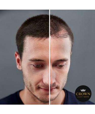 CROWN Hair Fibers for Thinning Hair - Dark Brown 0.87oz/25g Bottle | Natural Keratin Hair Loss Concealer for Men & Women - Buy Online on GoSupps.com