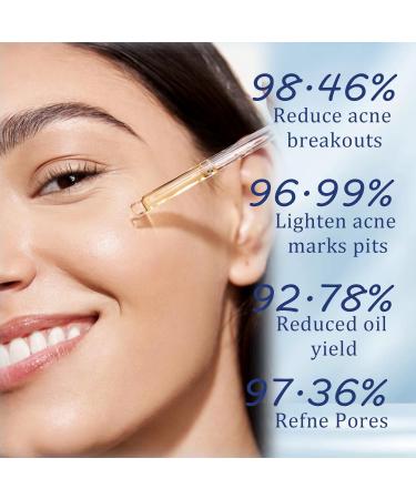 Faded Topicals for Dark Spots - Salicylic Acid Serum - Dark Spot Correcting Glow Serum - Moisturizing Niacinamide Serum with Vitamin C - Dark Spot Remover for Face - Removing Acne and Controlling Oil - Buy Online on GoSupps.com