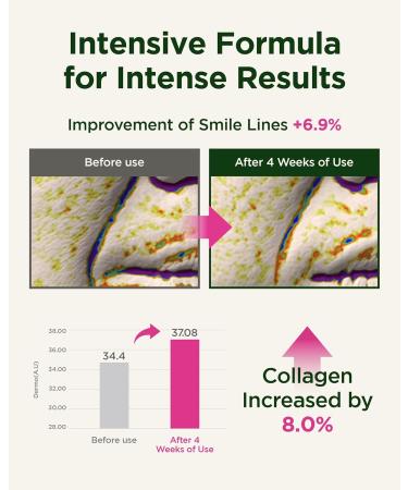 CKD Retinol Collagen Cream Bundle Anti-Aging & Lifting Set with Retinal and Massage Roller for Wrinkles Sagging and Firmness Korean Skincare Set - Buy Online on GoSupps.com