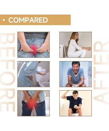 Chinese Hemorrhoid Cream Medalisk Hemorrhoid Cream Relieve Itching and Swelling Around The Anus to Break Hemorrhoids Inside and Outside Mixed Meat Ball Sores Apply Anal Relief Cream (2 PC) - Buy Online on GoSupps.com