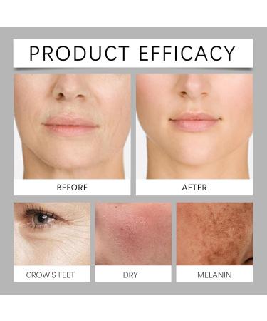 Lot de 2 cr mes anti-rides pour le visage - Hydratant en profondeur pour la peau - Am liore le contour - Am liore les rides profondes - Augmente le bourdonnement de la peau - Pour la journ e et - Buy Online on GoSupps.com