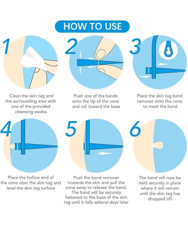 2-IN-1 Micro Skin Tag Tool Kit Quick and Painless Solution for Medium to Large Skin Tags (2mm-7mm) Complete Skin Tag Tool Kit for Fast Results - Buy Online on GoSupps.com