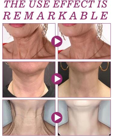 Tighten & Lift Neck Cream Neck Firming Cream - Best for Tightening Sagging Skin 2024 New Neck Firming Cream Tighten and Lift Neck Cream Neck Tightening Cream Neck Tightening Double-Chin Cream 50ml - Buy Online on GoSupps.com