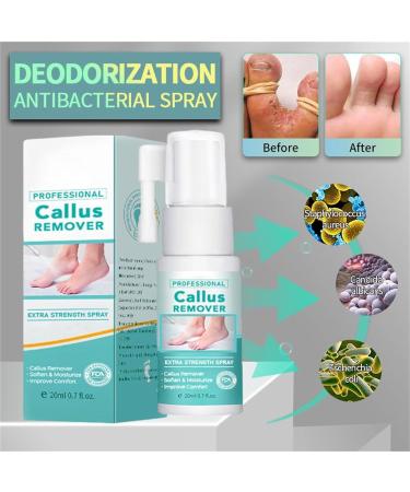 Professional Callus Remover Extra Strength Spray Foot Callus Removal Spray Foot Peeling Spray for Remove Dead Skin and Calluses on Feet (1Pcs) - Buy Online on GoSupps.com