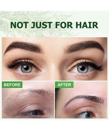 Rosemary Essential Oil for Hair Growth & Skin Care - 60ml | Promotes Hair Growth, Nourishes Scalp, Eyebrow, and Eyelash Growth - Men and Women - Buy Online on GoSupps.com