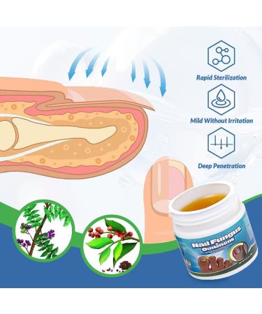 Soins des ongles de pied endog nes Cr me r paratrice pour les ongles Ongles R parateurs Renforce Les Ongles Favorise La Repousse D'ongles Sains Cr me professionnelle pour le soin des pieds(20g) - Buy Online on GoSupps.com