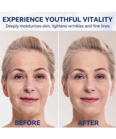 Premium Hydrating Hyaluronic Acid Serum - Anti-Aging Face Serum with Glycerin & Niacinamide for Men & Women | 30ml - Buy Online on GoSupps.com