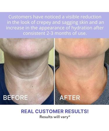 Tighten Neck Firming Cream Tighten And Lift Neck Cream Anti-Aging Neck Cream for Tightening Tighten and Lift Neck Cream Tightening Moisturizer for Neck Eliminates Wrinkles & Hydrating-Men & Women - Buy Online on GoSupps.com