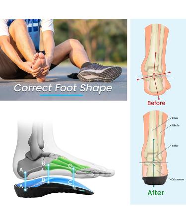 High Arch Support Insoles 3/4 Orthotic Inserts for Flat Feet Plantar Fasciitis Relief | Overpronation Running Shoe Insoles for Men & Women - Black/Blue (L Men 9-11 Women 10-12) - Buy Online on GoSupps.com
