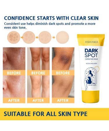 Dark Spot Remover for Face and Body: Advanced Corrector Formula for Inner Thighs Dark Neck & Knees Advanced Formula (2 Fl Oz) - Buy Online on GoSupps.com