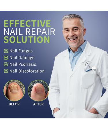 Effective Nail Fungus Light for Toenail & Fingernail Treatment | Restore Damaged & Discolored Nails - Buy Online on GoSupps.com