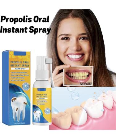 Propolis Oral Instant Treatment Spray - 2 Piece Set | Deep Cleaning Mouthwash & Refreshing Breath | Furzero Propolis Oral Health - Buy Online on GoSupps.com