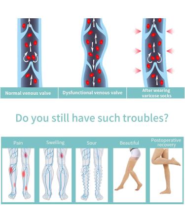 Evolyline Medical Compression Stockings for Men & Women | Thigh High Support 20-30 mmHg Varicose Veins Relief Silicone Band Ideal for Air Travel & Sports - Black XL - Buy Online on GoSupps.com