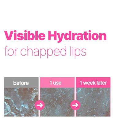 ISOI Refresh Lip Sleeping Mask Overnight Hydrating Lip Treatment with 4X Ceramide & Botanical Oils Korean Lip Care (0.88 oz 25g) - Buy Online on GoSupps.com