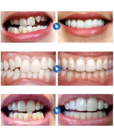 Lifi 4 Paires de Proth ses Dentaires Cosm tiques | Facettes Dentaire Dentier Temporaire & Blanchiment des Dents - Am liorez Votre Sourire ! - Buy Online on GoSupps.com