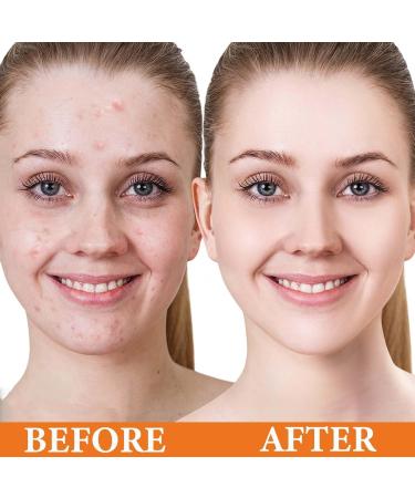 Relief Sun Rice Sunscreen SPF50 PA+++ | Nourishing Korean Facial Sunscreen for All Skin Types - Ultimate UV Defense - Buy Online on GoSupps.com