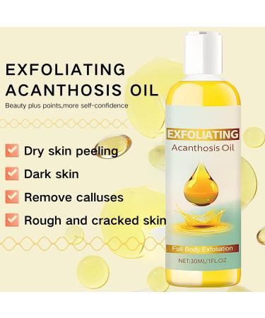 Exfoliating Acanthosis Peeling Oil Exfoliation Body Oil Peeling Solution Skin Peel Dark Spot Corrector Oil Yellow Peeling Oil Body Skin Care Exfoliation Oil Dark Spot Remover For Body Hand Feet - Buy Online on GoSupps.com