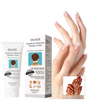 2Pcs Advanced Acanthosis Nigricans Treatment Body Cream - Cream Dark Neck Cream - Perfect Solution for Damaged Skin - Exfoliating Therapy Oil