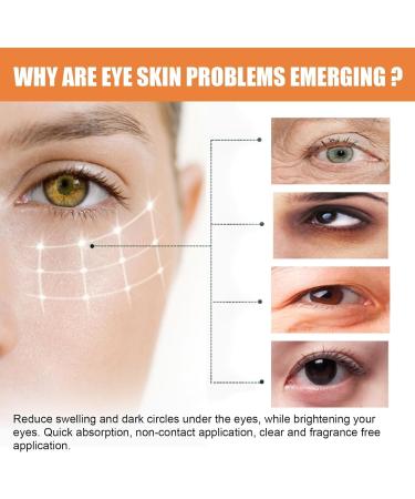 Eye Cream - Eye Balm - Contains Vitamin C Vitamin C Eye Balm with Cream - Moisturizes Brightens Reduces Dark Circles and Firms Eye Area - Buy Online on GoSupps.com